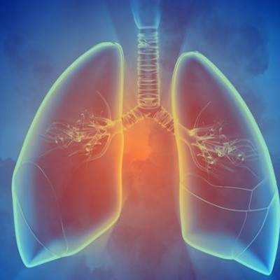 Cintilografia de Ventilação Pulmonar