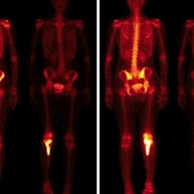 Pesquisa de Corpo Inteiro (PCI)