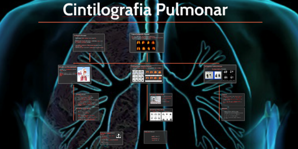 Cintilografia de Perfusão Pulmonar