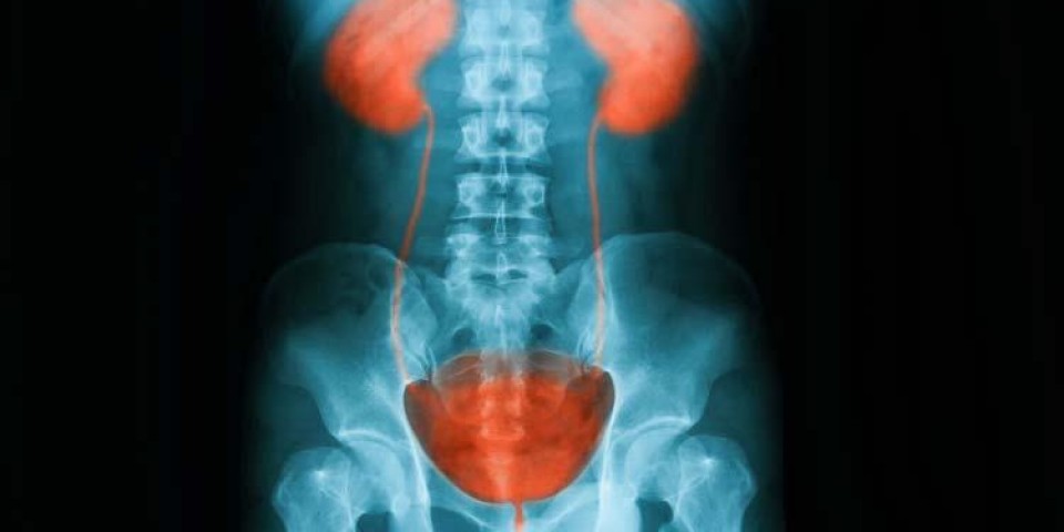 Estudo Renal Dinâmico com Captopril (DTPA/EC- Tecnécio 99)