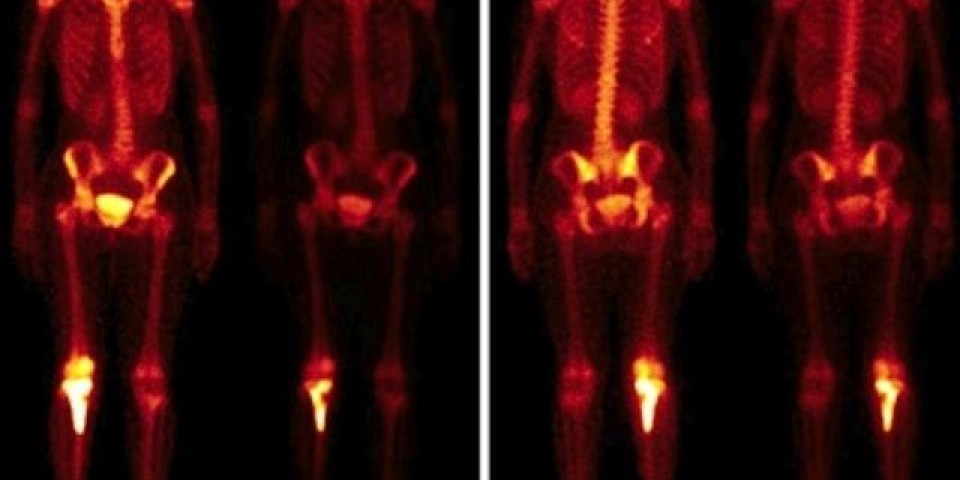 Pesquisa de Corpo Inteiro (PCI)