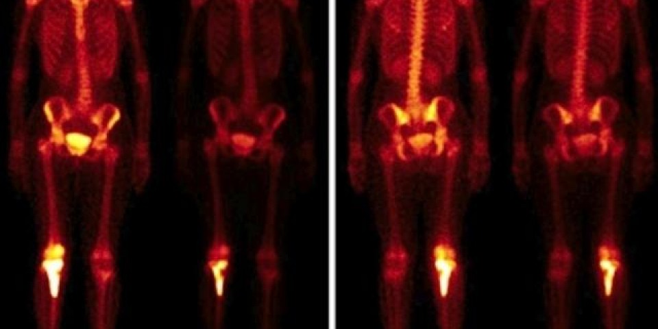 Pesquisa de Corpo Inteiro (PCI)